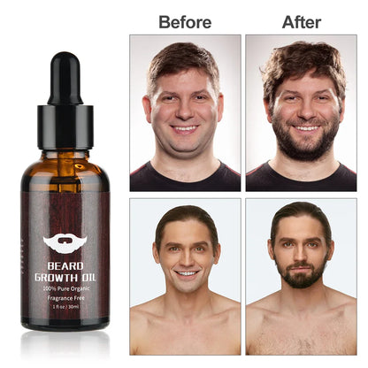 BeardBoost™ - Beard Growth Kit